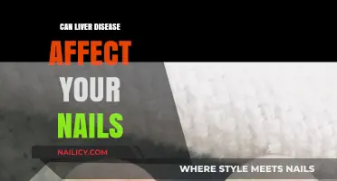 Unveiling the Connection: Liver Disease and Its Impact on Nail Health