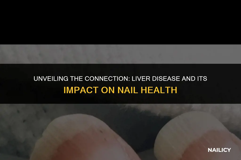 can liver disease affect your nails