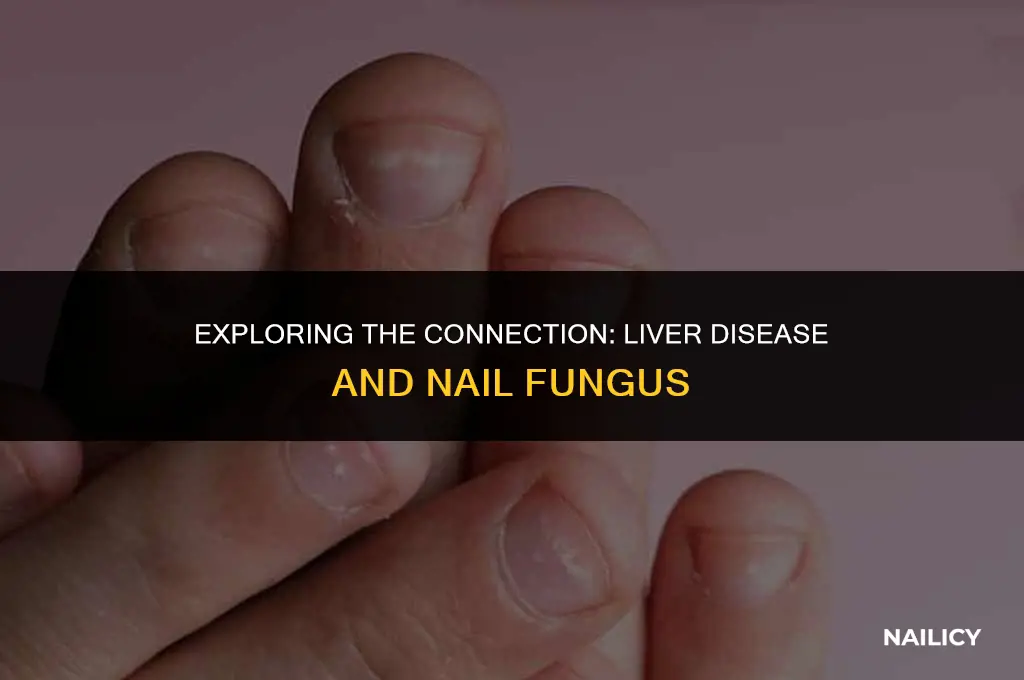 can liver disease cause nail fungus