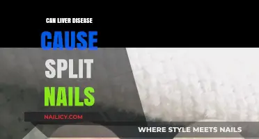 Exploring the Connection: Liver Disease and Split Nails
