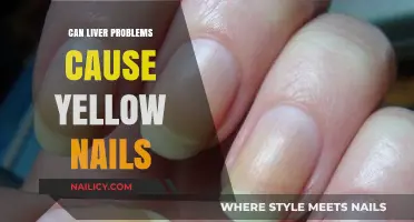 Unveiling the Connection: Liver Health and Yellow Nail Syndrome