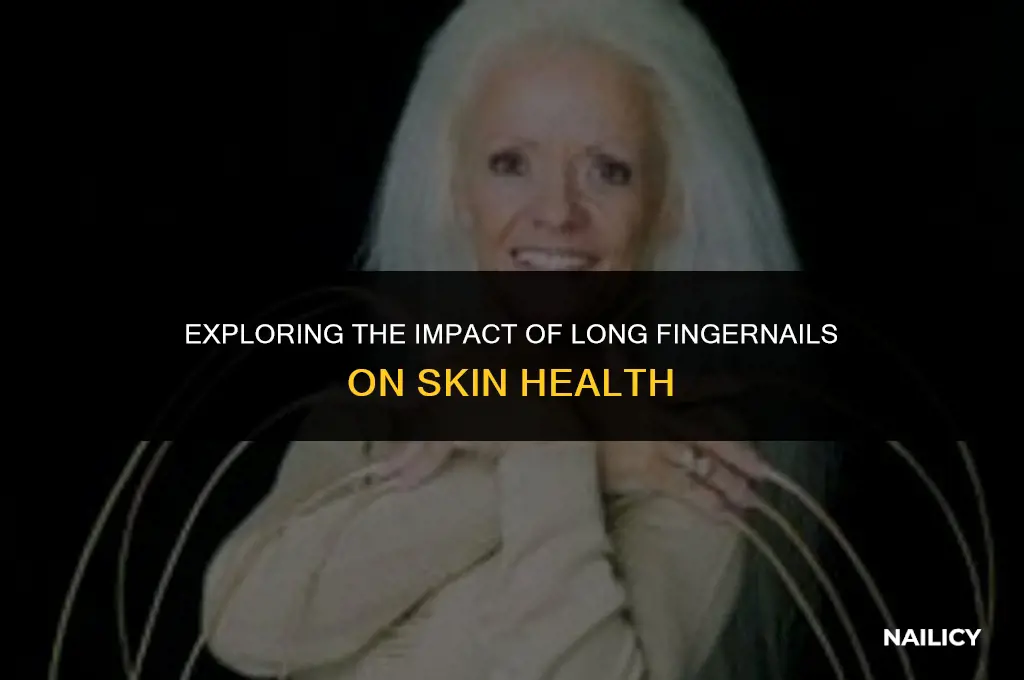 can long finger nails lead to skin breakdown