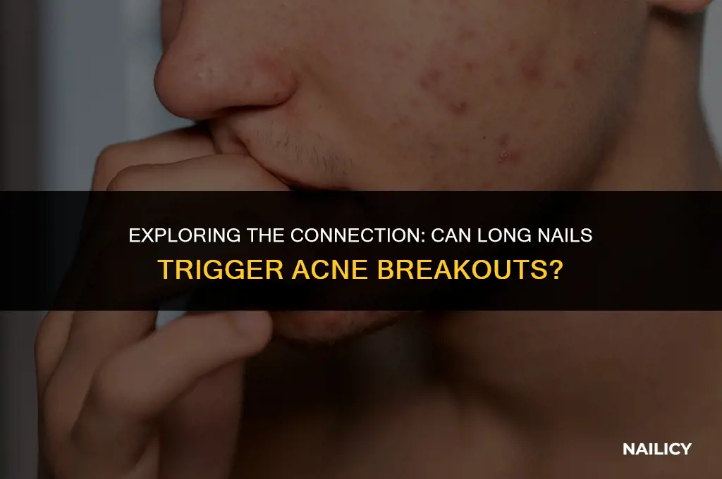 can long nails cause acne