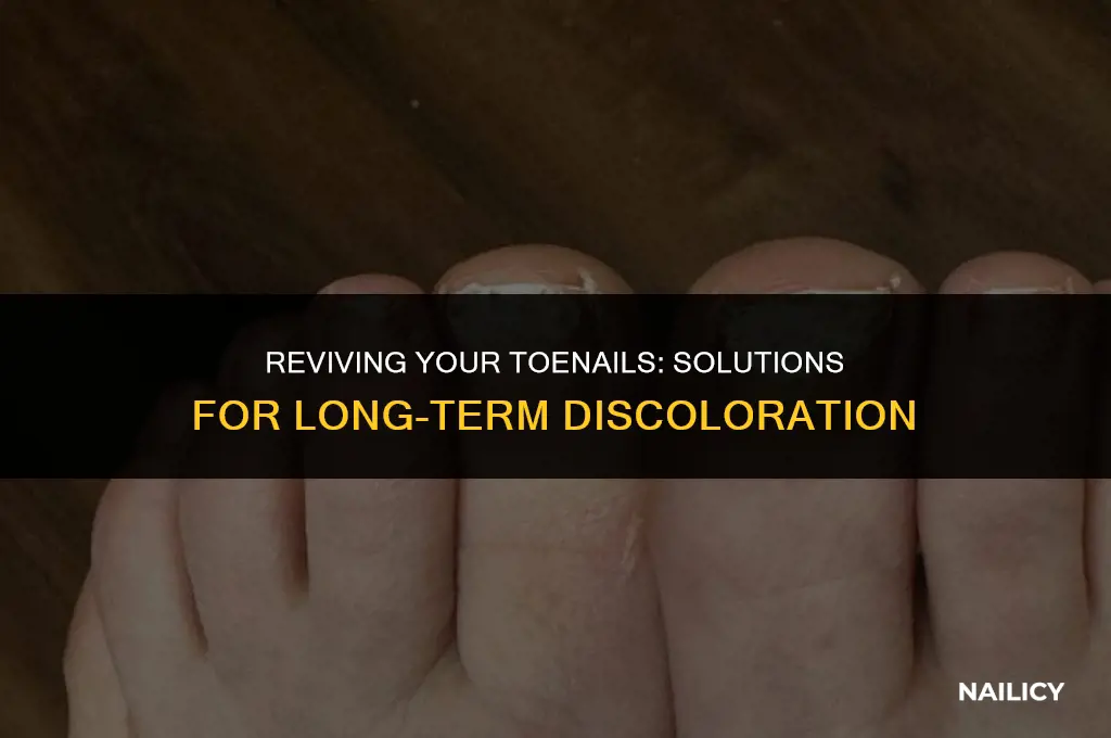 can long term toe nail discoloration be fixed