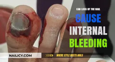 Toenail Trauma: Unveiling the Link to Internal Bleeding Risks