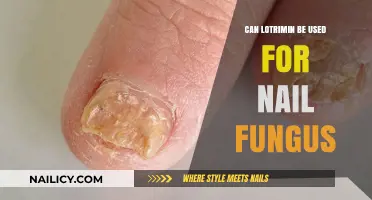 Exploring Lotrimin's Efficacy Against Nail Fungus: A Comprehensive Guide