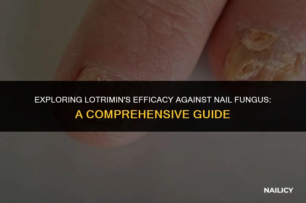 can lotrimin be used for nail fungus