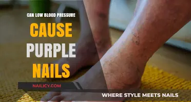 Exploring the Link: Low Blood Pressure and Purple Nails