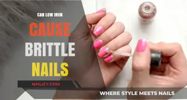 Brittle Nails: The Surprising Connection to Low Iron Levels
