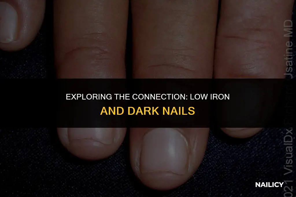 can low iron cause dark nails