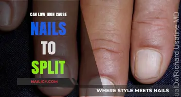 Exploring the Link Between Low Iron and Brittle Nails