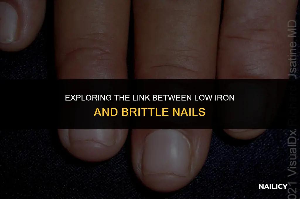can low iron cause nails to split