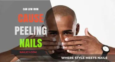Unveiling the Truth: Low Iron and Peeling Nails Connection