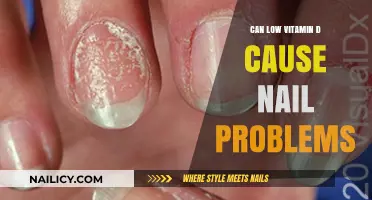 Exploring the Link: Vitamin D Deficiency and Nail Health Concerns