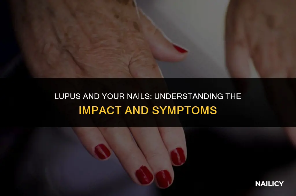 can lupus affect your nails