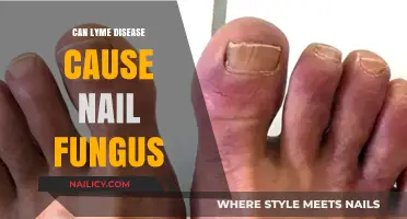 Exploring the Link: Lyme Disease and Nail Fungus Connection