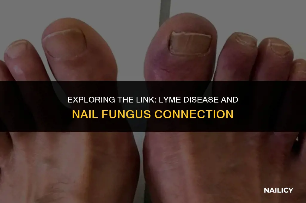 can lyme disease cause nail fungus