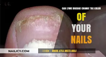 Exploring the Link: Lyme Disease and Nail Color Changes