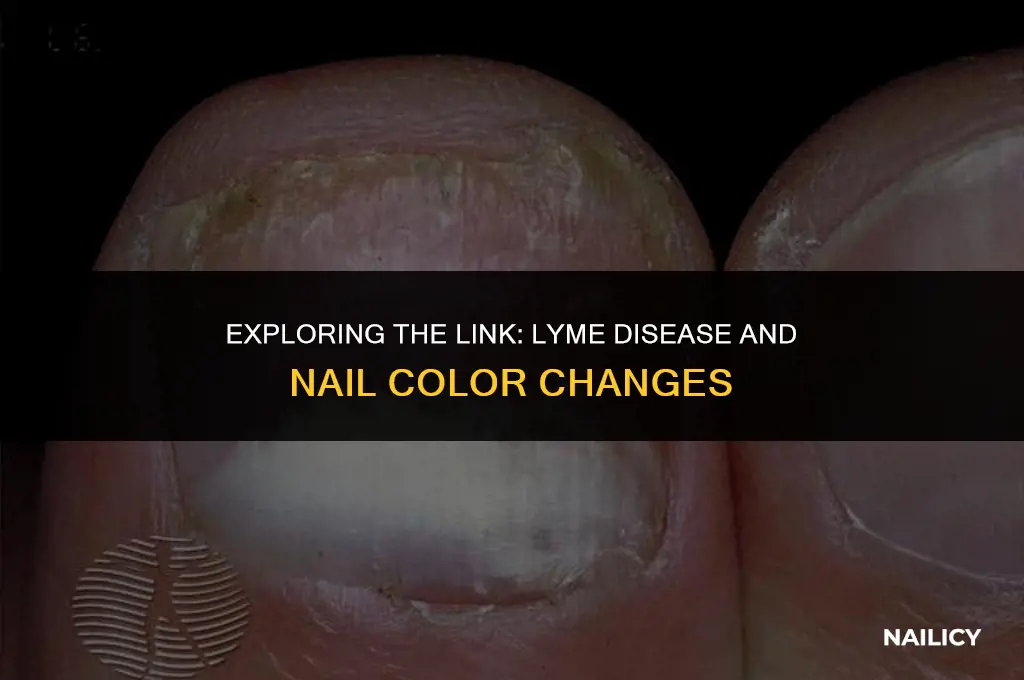 can lyme disease change the color of your nails