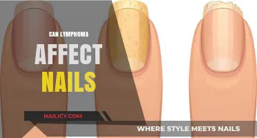 Exploring the Link: Lymphoma's Potential Impact on Nail Health