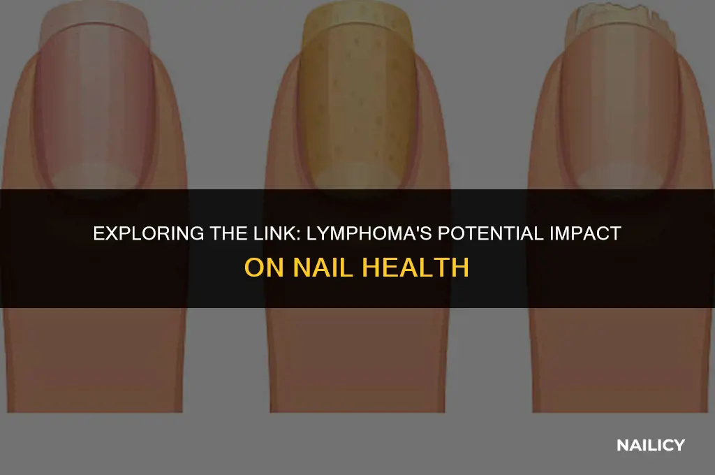 can lymphoma affect nails