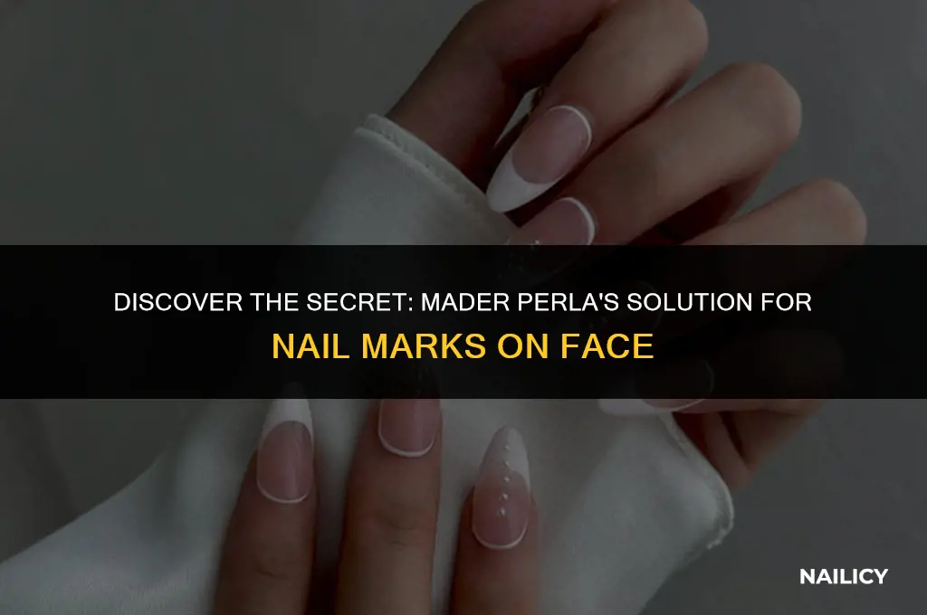 can mader perla help take away nail marks off face