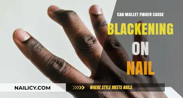 Can Mallet Finger Lead to Blackening of the Nail?