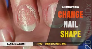 Exploring the Surprising Link Between Malnutrition and Nail Health