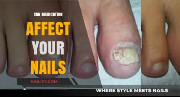 Exploring the Impact of Medications on Nail Health