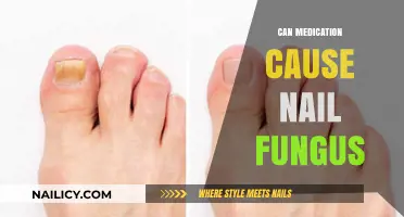 Exploring the Link: Can Medication Trigger Nail Fungus?