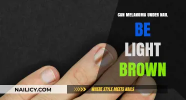 Unveiling the Truth: Can Melanoma Under the Nail Be Light Brown?