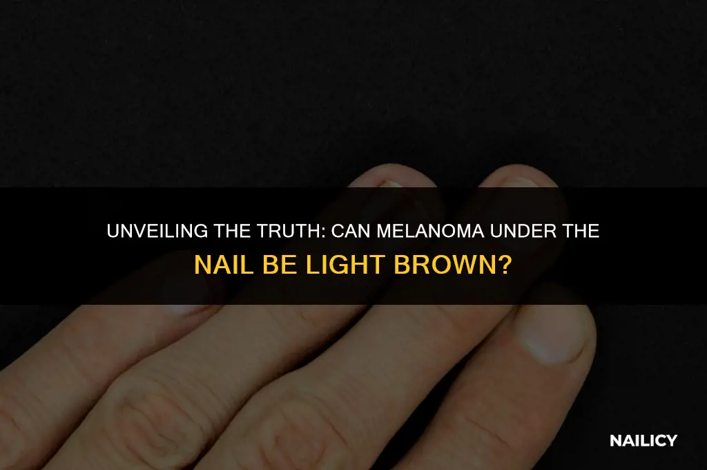 can melanoma under nail be light brown