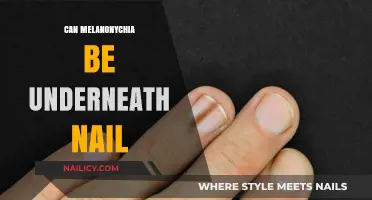 Exploring Melanonychia: Can This Condition Affect the Nail Bed?