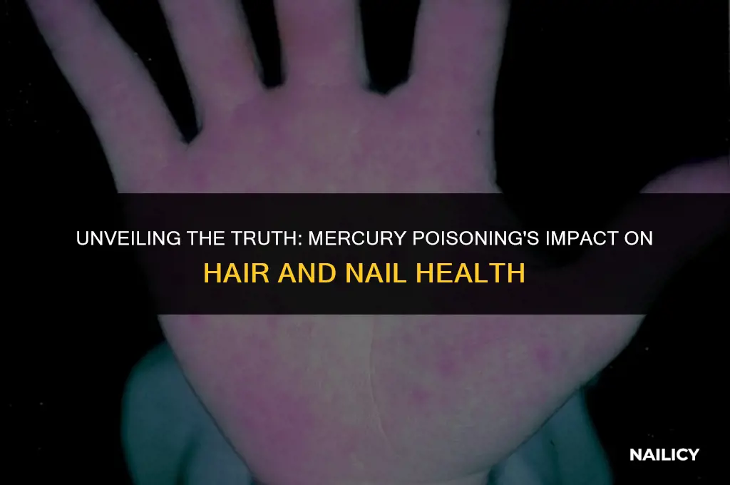 can mercury poisoning cause brittle hair and nails