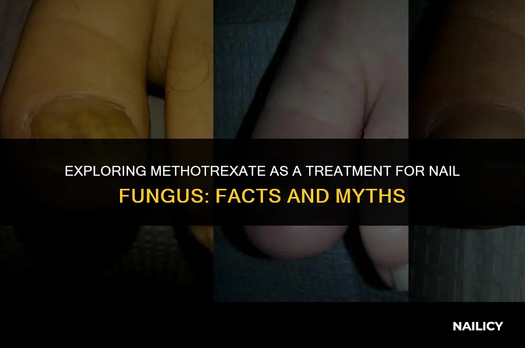 can methotrexate clear nail fungus