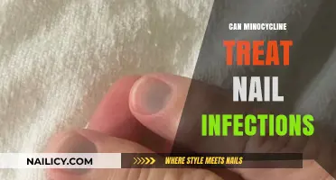 Exploring Minocycline's Potential in Treating Nail Infections