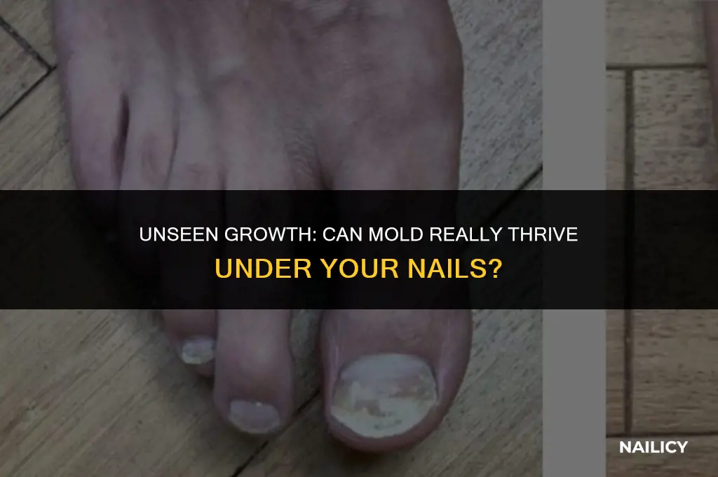 can mold grow under your nails