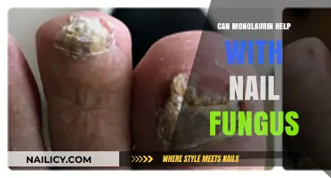 Exploring Monolaurin's Potential in Combating Nail Fungus