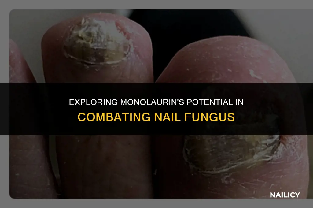 can monolaurin help with nail fungus