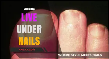 Unveiling the Truth: Can MRSA Lurk Beneath Your Nails?