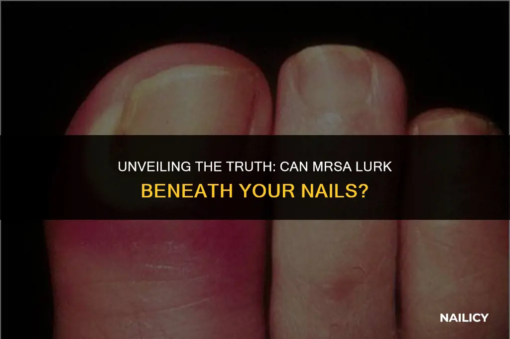can mrsa live under nails