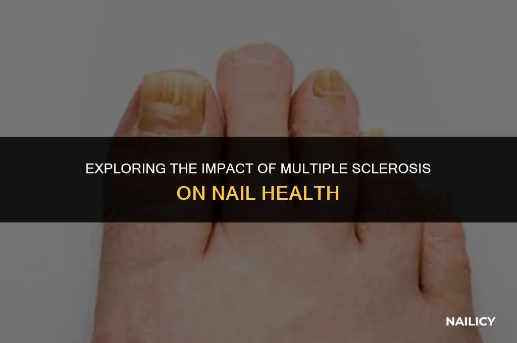 can ms affect nails