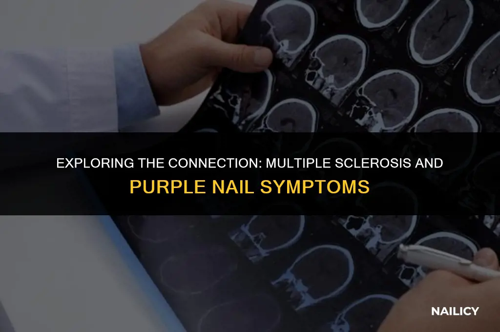 can ms cause purple nails