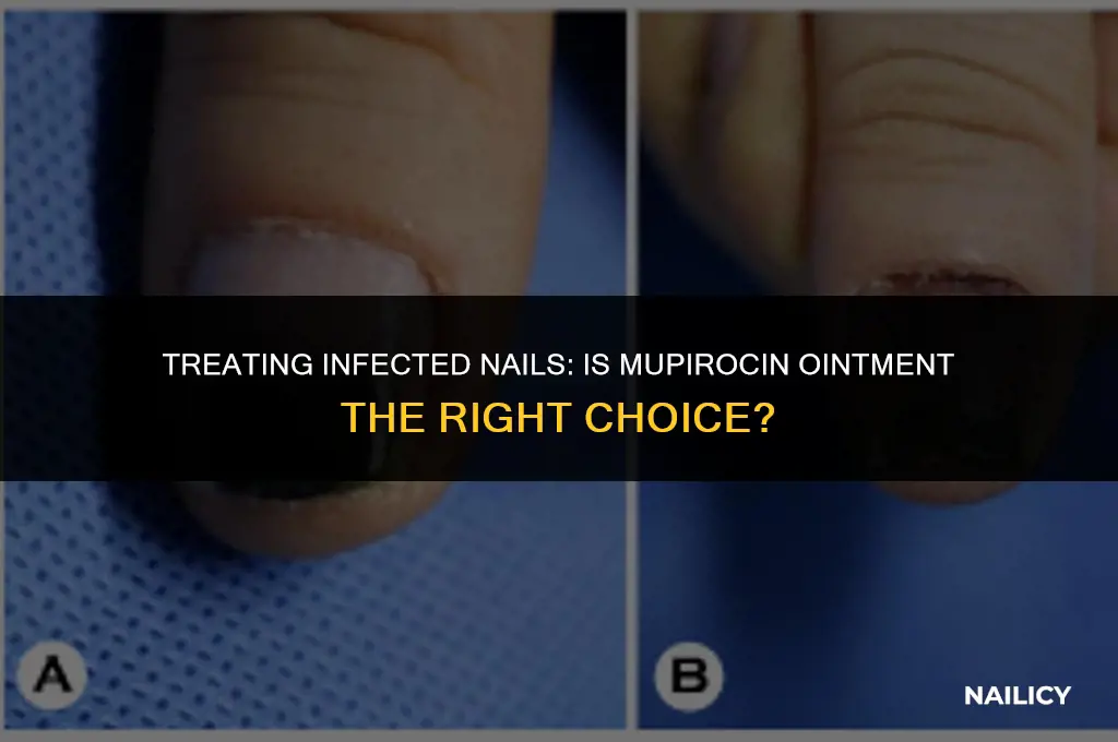 can mupirocin ointment be used on infected nail