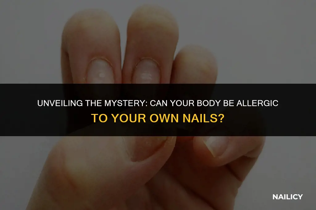 can my body be allergic to my own nails