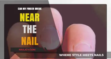 Understanding Finger Injuries: Can Your Finger Break Near the Nail?