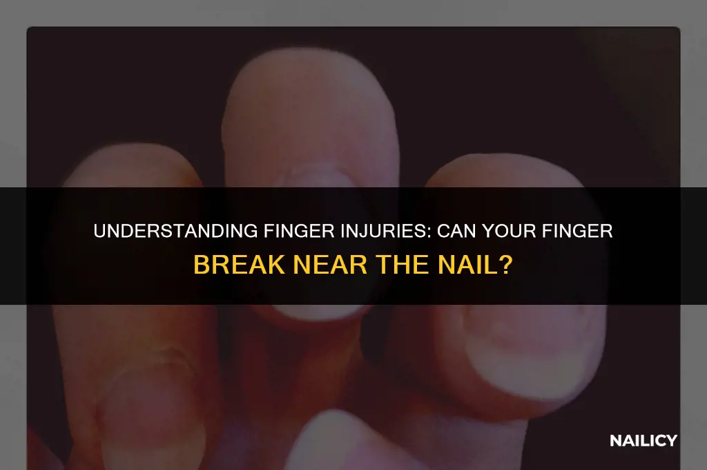 can my finger break near the nail