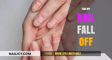Nail Health Concerns: Understanding the Risks of Nail Detachment