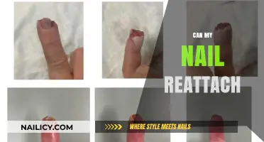 Nail Reattachment: A Comprehensive Guide to Healing and Care