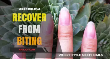 Nail Recovery Journey: Overcoming the Habit of Biting